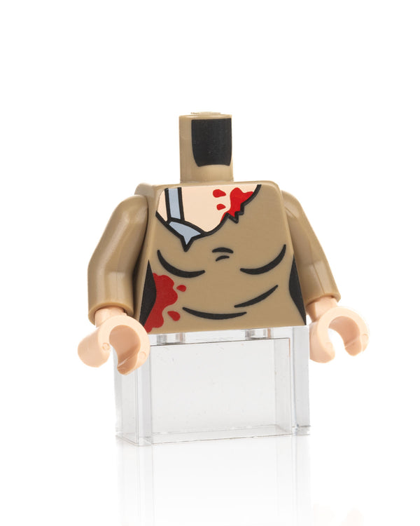 Infected torso - Female